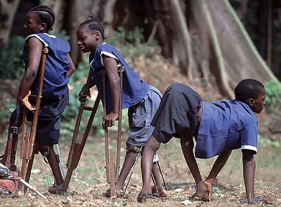 Children with polio